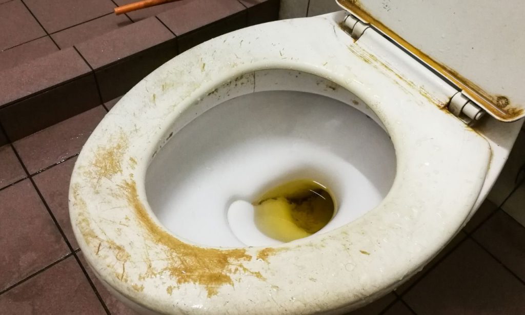 What Causes Yellow Stains in Toilet Bowl